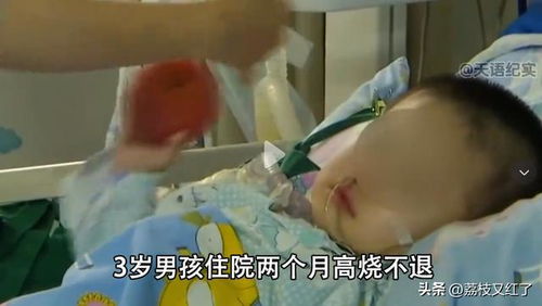 男童高烧不退一查全家感染肝吸虫 男童高烧不退一查全家感染肝吸虫